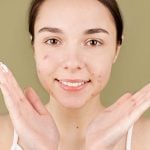 Tipologie di acne e brufoli: come riconoscerle (e combatterle)